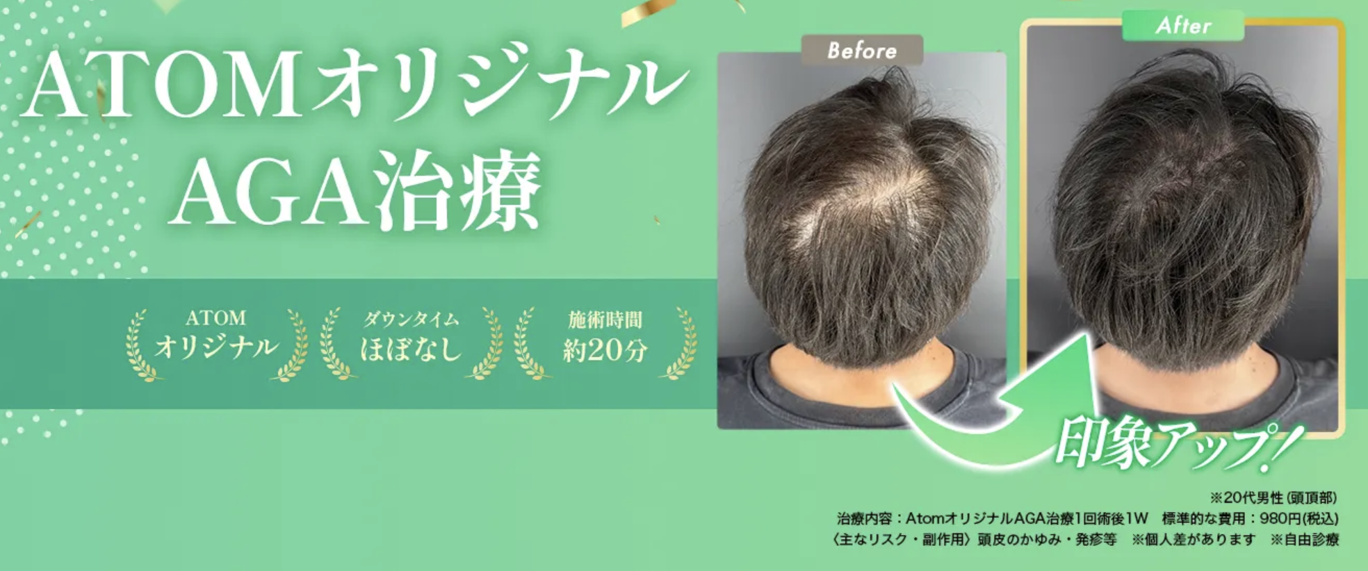 アトムクリニックのはえちょる。でLINE相談するイメージ