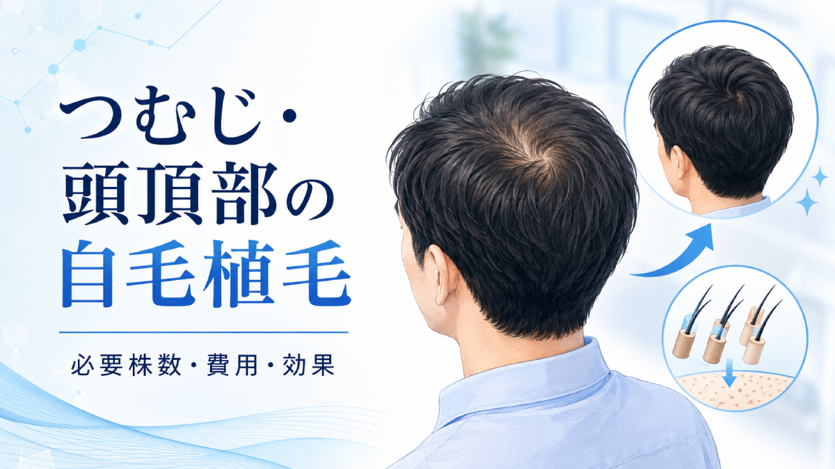 つむじ・頭頂部の自毛植毛｜必要株数・費用・効果を解説