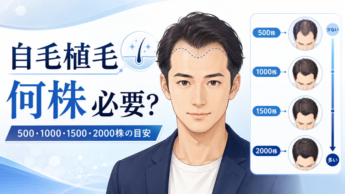 自毛植毛には何株必要？500・1000・1500・2000株の目安